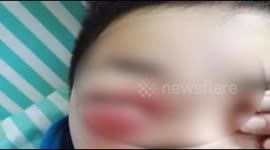 Boy is almost blind after playing computer games for a long time