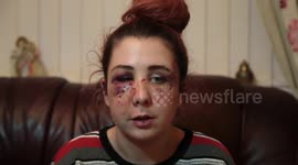 Autistic 16yo girl left with horrific facial injuries after battered by yob
