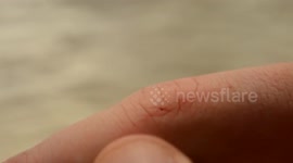 How to apply band-aid on or near the fingertips