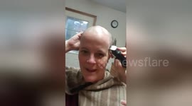 Woman suffering from alopecia shaves her hair off