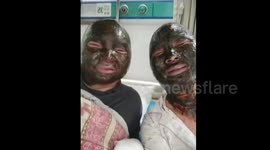 湖南邵阳 麻将桌发生爆炸四名牌友被炸伤 朋友圈的合影笑死人