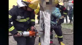 Boy climbing tree gets leg stuck in trunks