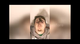 Man places wild tarantula on his face