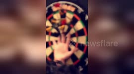 Dart thrown into man's palm