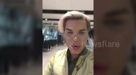 'Ken Doll' man in India for super-risky implant to change colour of his EYES