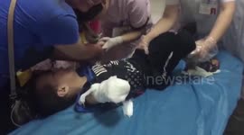 Boy's arm gets sucked into escalator in China