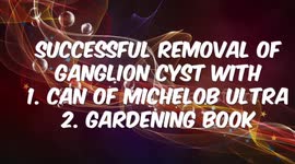 Amazing Ganglion Cyst Removal