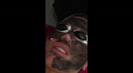 The Human Ken Doll Rodrigo Alves has a Vampire lift