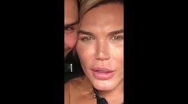 Human ken Doll Rodrigo Alves Gets Fat Freezing