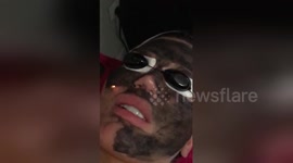 Newsflare Edit - The Human Ken Doll Rodrigo Alves has a Vampire lift