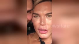 Newsflare Edit - Human ken Doll Rodrigo Alves Gets Fat Freezing