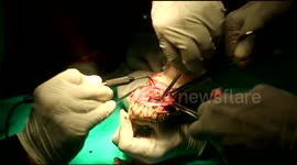 Tumour removed from mouth of python in rare surgery