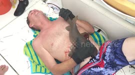 Shark bites Florida man and will not let go