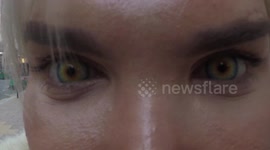 Closeup of 'human Ken doll' Rodrigo Alves' new eyes