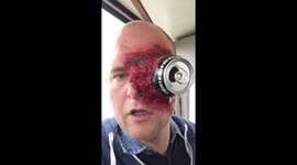Essex man struggles to remove Halloween costume from his head