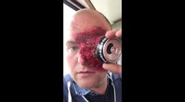 Essex man struggles to remove Halloween costume from his face