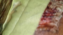 ***GRAPHIC GRUESOME SCABS*** Skin grafts (Week 2 healing)