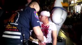 Tourist covered in blood after alleged attack by man from Britain