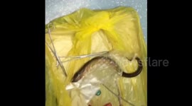 Chinese doctors remove Asian swamp eel from man's body