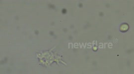 Amoeba feeding on algae