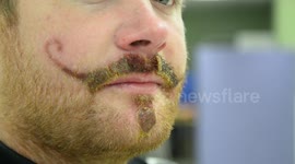 Holidaymaker potentially scarred for life - by a henna tattoo MOUSTACHE.