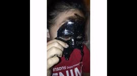 Hilarious footage of woman with face mask stuck to her eyebrows