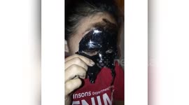 Hilarious footage of woman pulling off her eyebrows in face mask removal