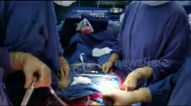 Indian man ends up with two hearts after surgery