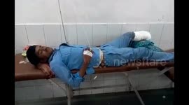 Accident victim’s severed leg used as pillow in Indian hospital