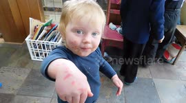 Two Year Old Girl Finally Talks