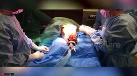 Acid attack-suffering Pony having skin fixed with pioneering FISH skin