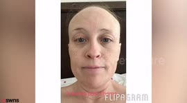 Cancer-surviving mother keeps photo diary of her hair recovery