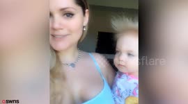 This adorable baby has 'Uncombable Hair Syndrome'