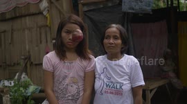 Teenager who has struggled with eye tumour her whole life