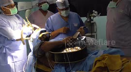 Amazing moment musician plays guitar during brain surgery