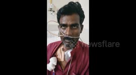 Indian doctors remove 3.5cm chicken bone from man's throat in four-hour operation