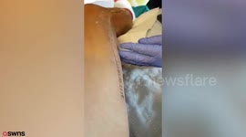 Woman who scratched her leg on a rusty nail is struck down by a flesh-eating bug - which left her fighting for her life in hospital