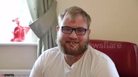 Hospital worker tells how painful psoriasis has turned him into a