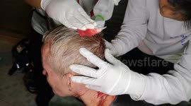 Blood-covered Brit bottled by Thai bar girl