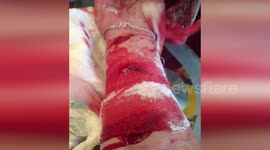 Woman left bleeding badly after Russian special forces mistakenly raid her home