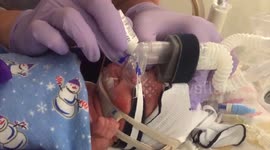 Meet incredible baby Grace born FOUR MONTHS premature