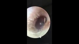 The ant crawling in the ears of the 4-year-old boy
