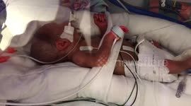 Twins born at 28 weeks return home after defying the odds to survive