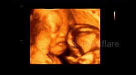 The baby waving hand with the symbol