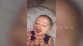 Baby smiles for first time after undergoing surgery to rebuild mouth