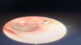 The spider attacks and makes the nest in the woman's ear