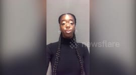 Model with vitiligo becomes the face of a New York billboard