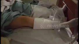 Young woman, 25, who had her left eye removed to treat an aggressive cancer has now fought off a brain tumour