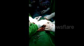 Indian doctor discharged after 'pouring' edible salt into cancer patient during surgery