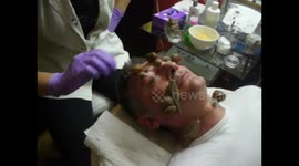 Treatment of snails rejuvenation cosmetic salon Mon cheri Andjela